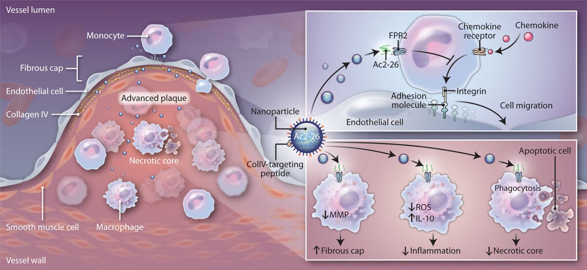 Targeted nanomedicines are able to significantly repair damage to the arteries and stabilize plaque (Image: Ira Tabas/Columbia University Medical Center)