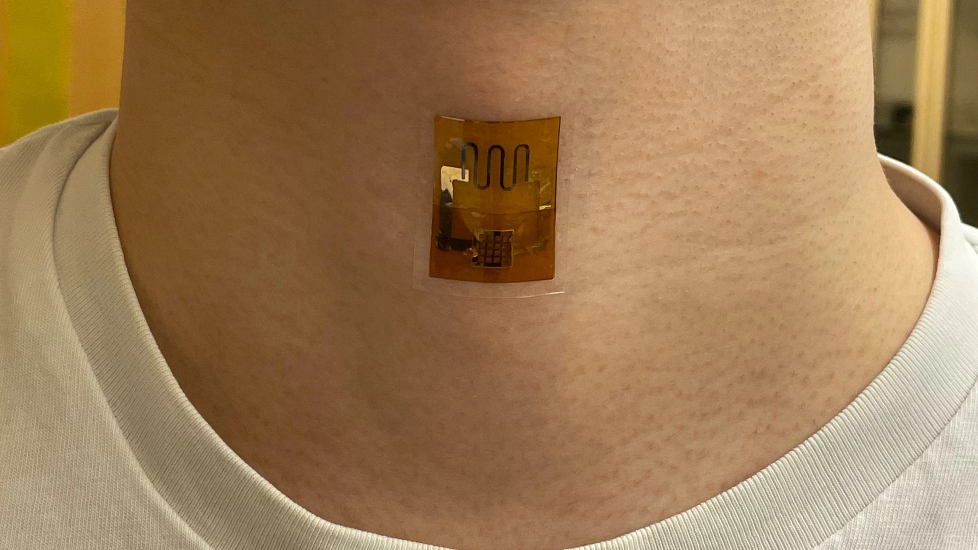 The UMass biofilm power source, built into a skin patch with a strain sensor designed to track swallowing motions
