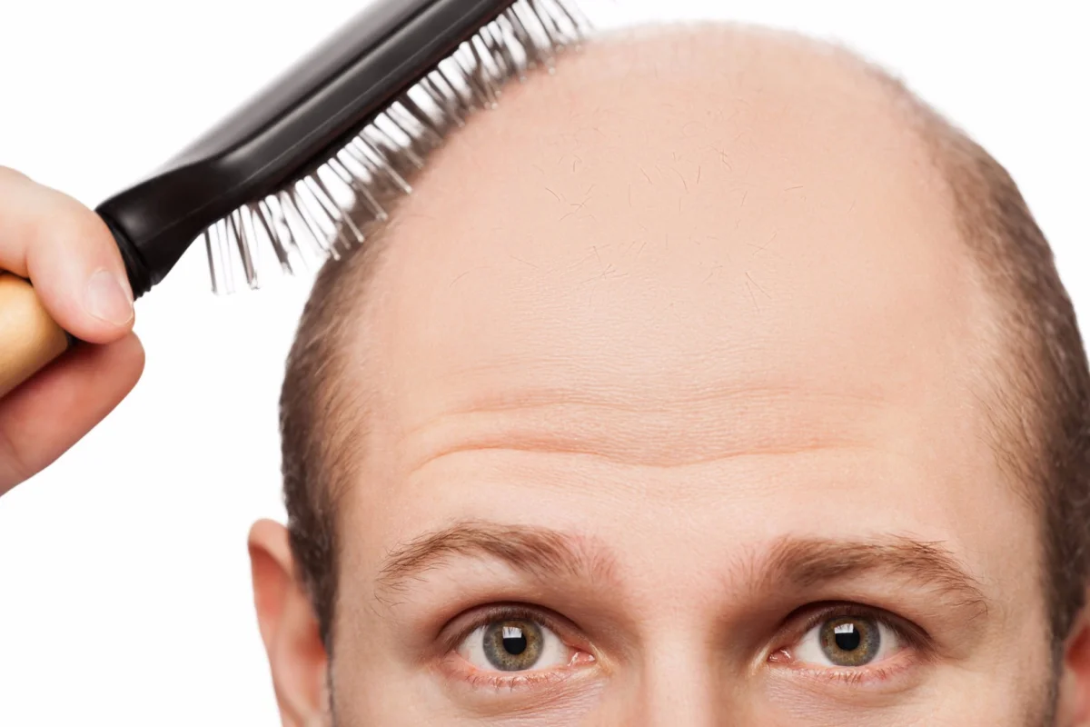 A small study is claiming premature graying and hair loss could signal an increased risk of heart disease