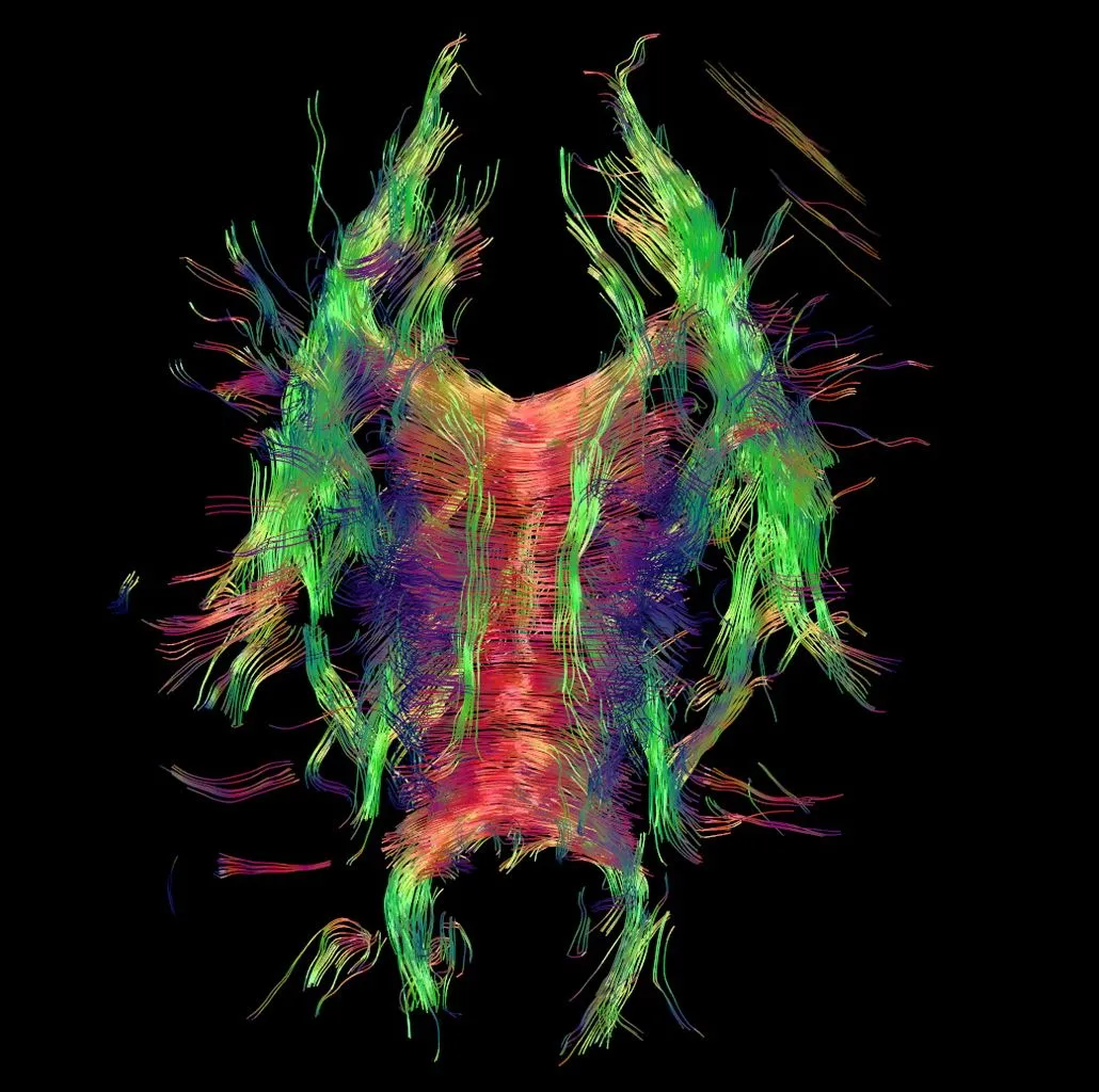 An image of a brain's wiring system, acquired using the new software