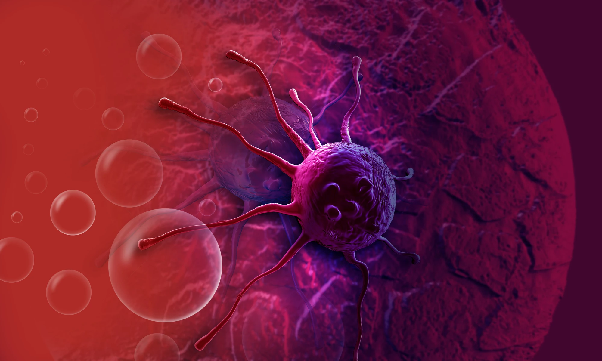 Mutations in the KRAS gene are associated with pancreatic cancer, but a new study has found a way to fight them