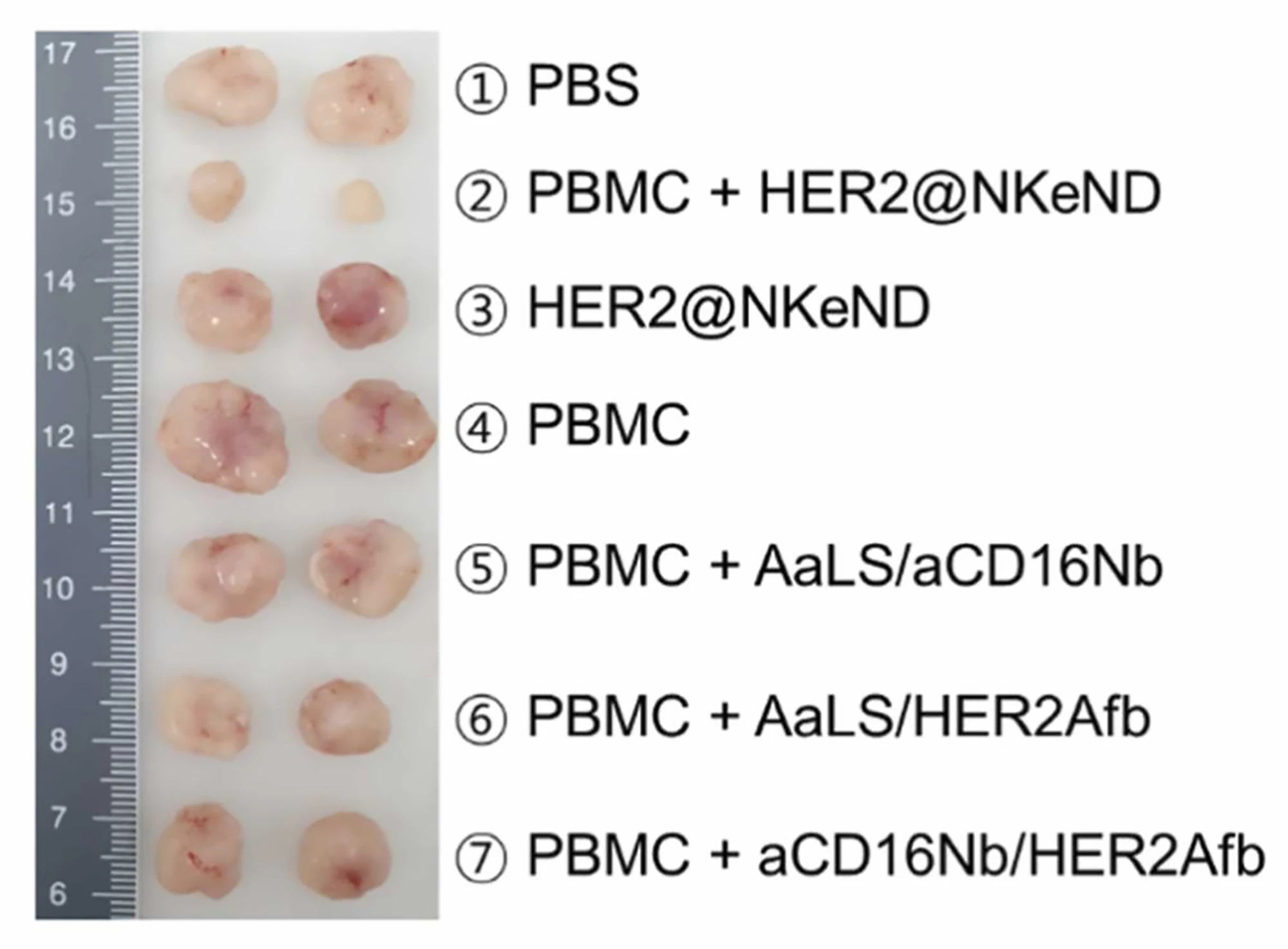 PBMC plus HER2@NKeND (2) produced a significant reduction in tumor size compared to other treatments