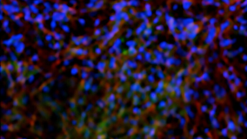 The researchers were able to guide the stem cells into becoming osteoblasts, seen here in an artificially colored image