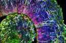 A cross-section of a mini-brain. Different colors indicate different types of brain cells.