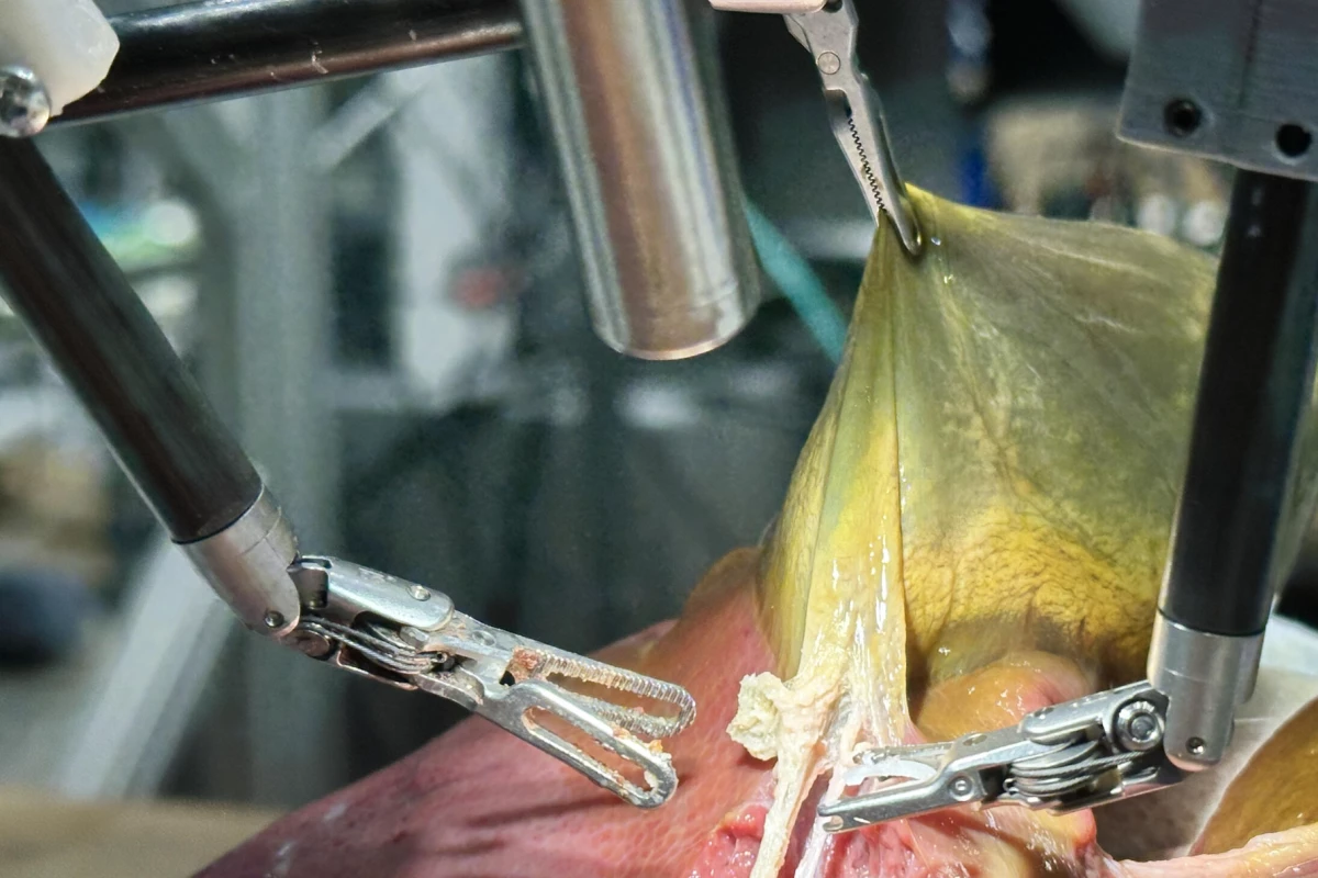 Autonomous Robotic Surgeon Achieves Flawless Organ Removal with 100% Success Rate We’re moving closer to operating rooms where we’re the only humans present, thanks to the world’s first surgery carried out by a robot that could respond and learn in real time. Its precision and expertise were on par with that of veteran surgeons.