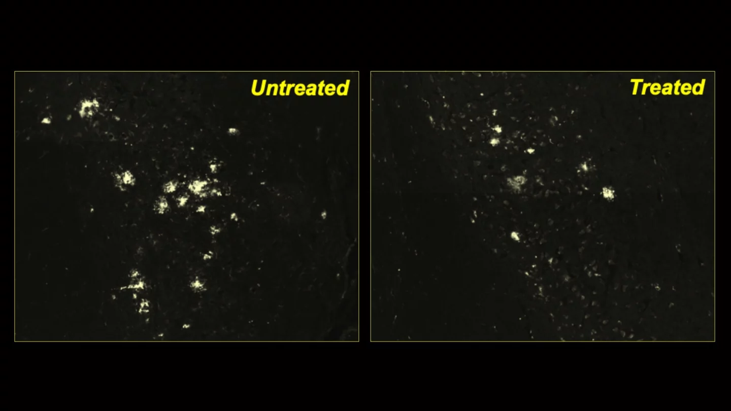 Fewer protein clumps can be see in mice treated with a novel drug to boost cellular cleaning