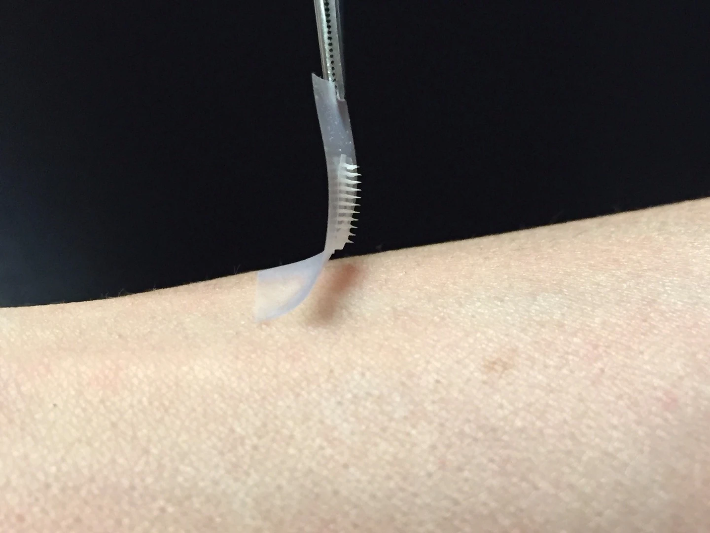 A smart patch boasting an array of over 100 insulin-carrying microneedles could be an option for diabetics in the future