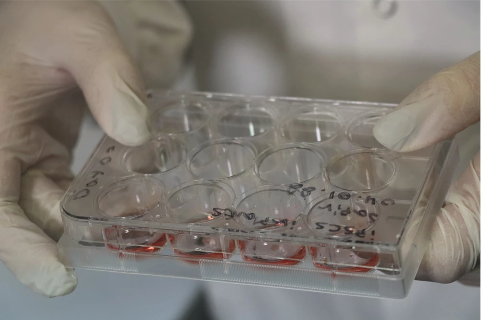 Some of the belly fat tissue samples used in the study