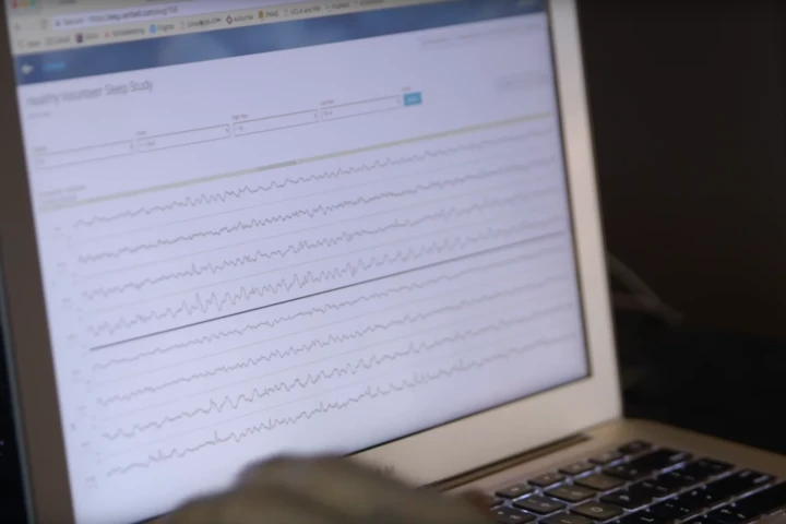 Stanford scientists have developed a "brain stethoscope" that translates brain waves into sound, making the onset of seizures easily identifiable