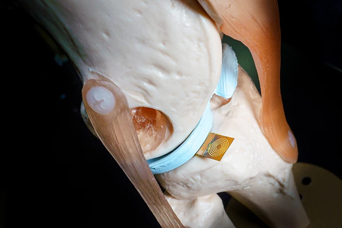 A ForceSticker was successfully tested in a model knee joint