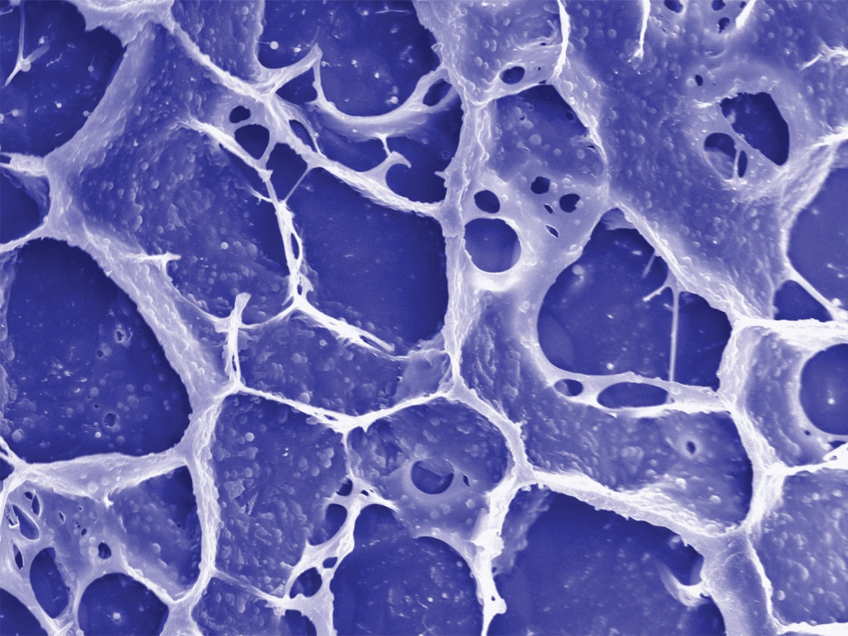 The gel helps the immune system target and kill any cancer cells that remain after tumor-removal surgery