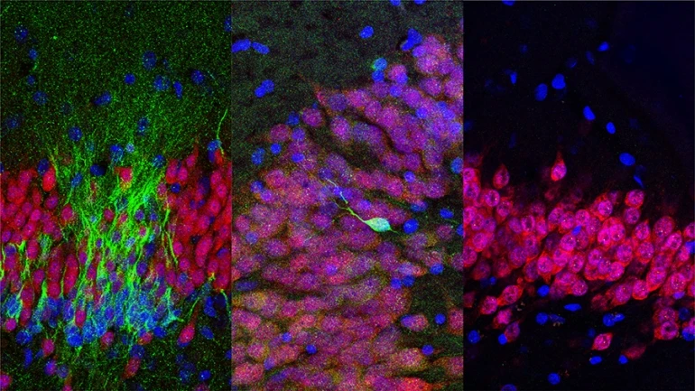 Young neurons (green) are shown in the human hippocampus at the ages of (from left) birth, 13 years old and 35 years old