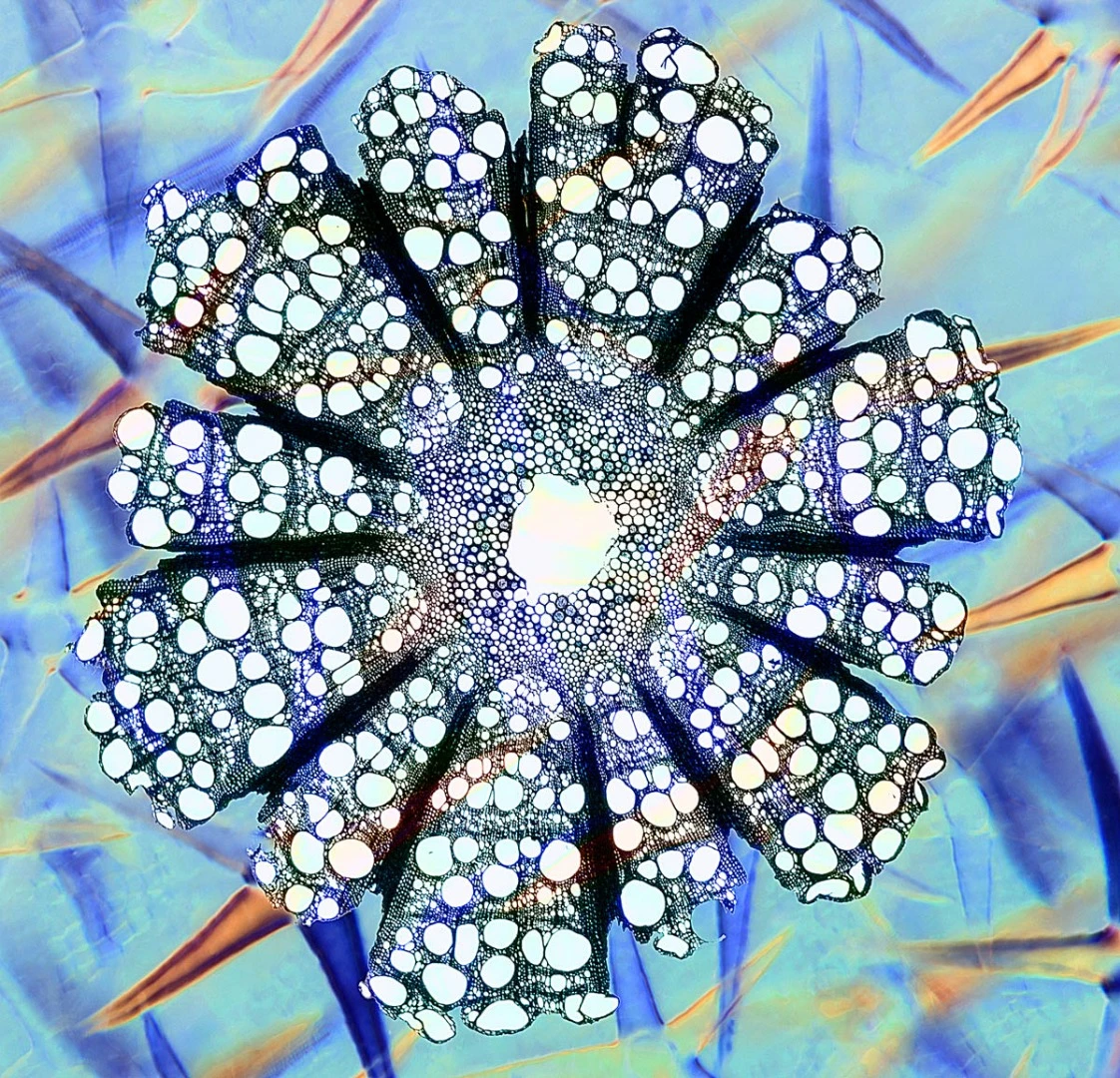 Highly Commended, Deutzia & Clematis. Portstewart, Northern Ireland, United Kingdom. "Polarised light microscopy photograph of Deutzia stellate leaf hairs and a cross-section of a Clematis stem."