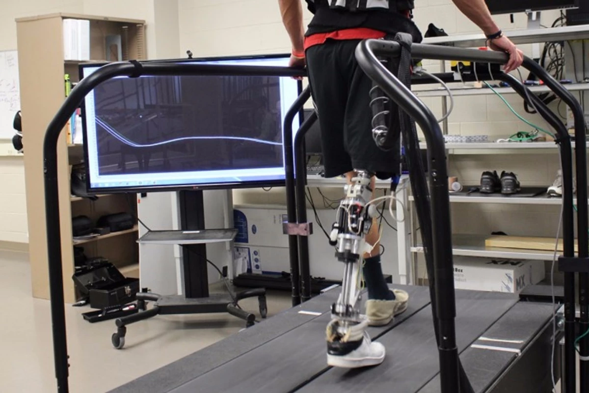 The algorithm automatically adjusts a powered artificial limb as the patient's physical and behavioral condition changes
