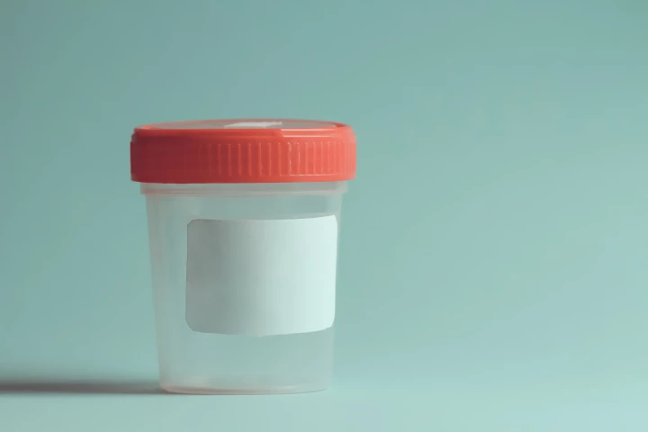 MIT researchers have developed nanoparticles that can reveal cancer through a urine test, and in follow-ups pinpoint its location in the body