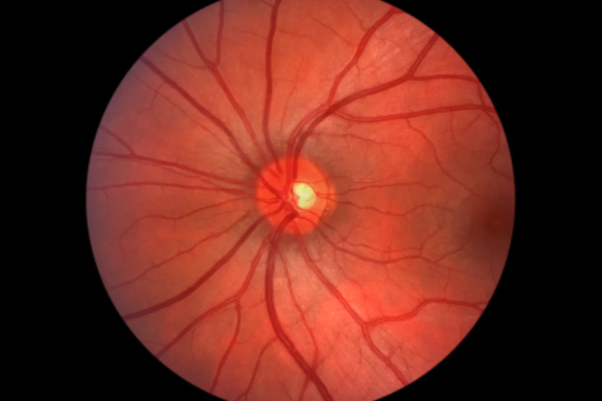 iPhones can now be used to obtain high-quality images of the retina (Photo: Shutterstock)