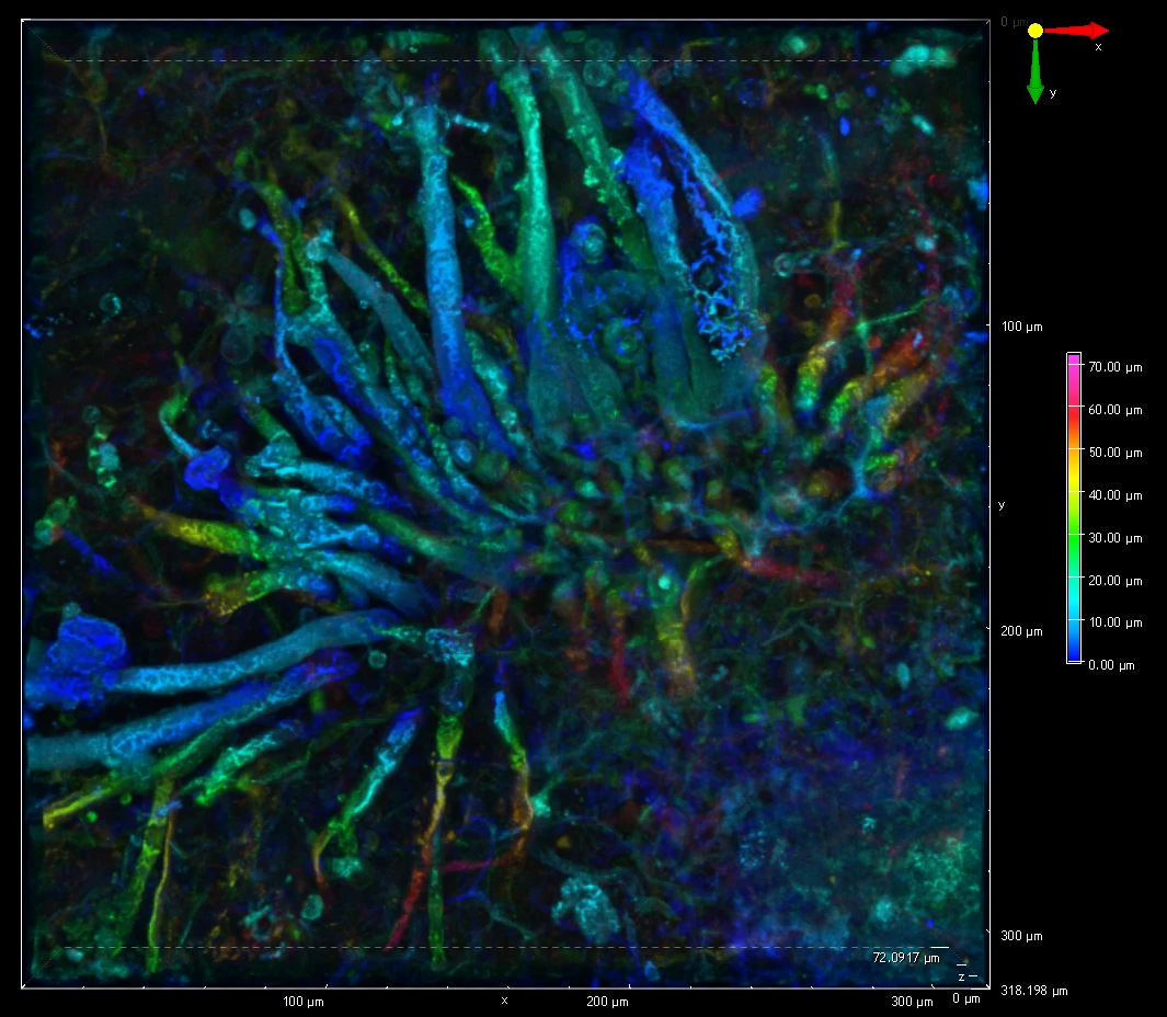 Technology allowed the researchers to identify this novel fungal species