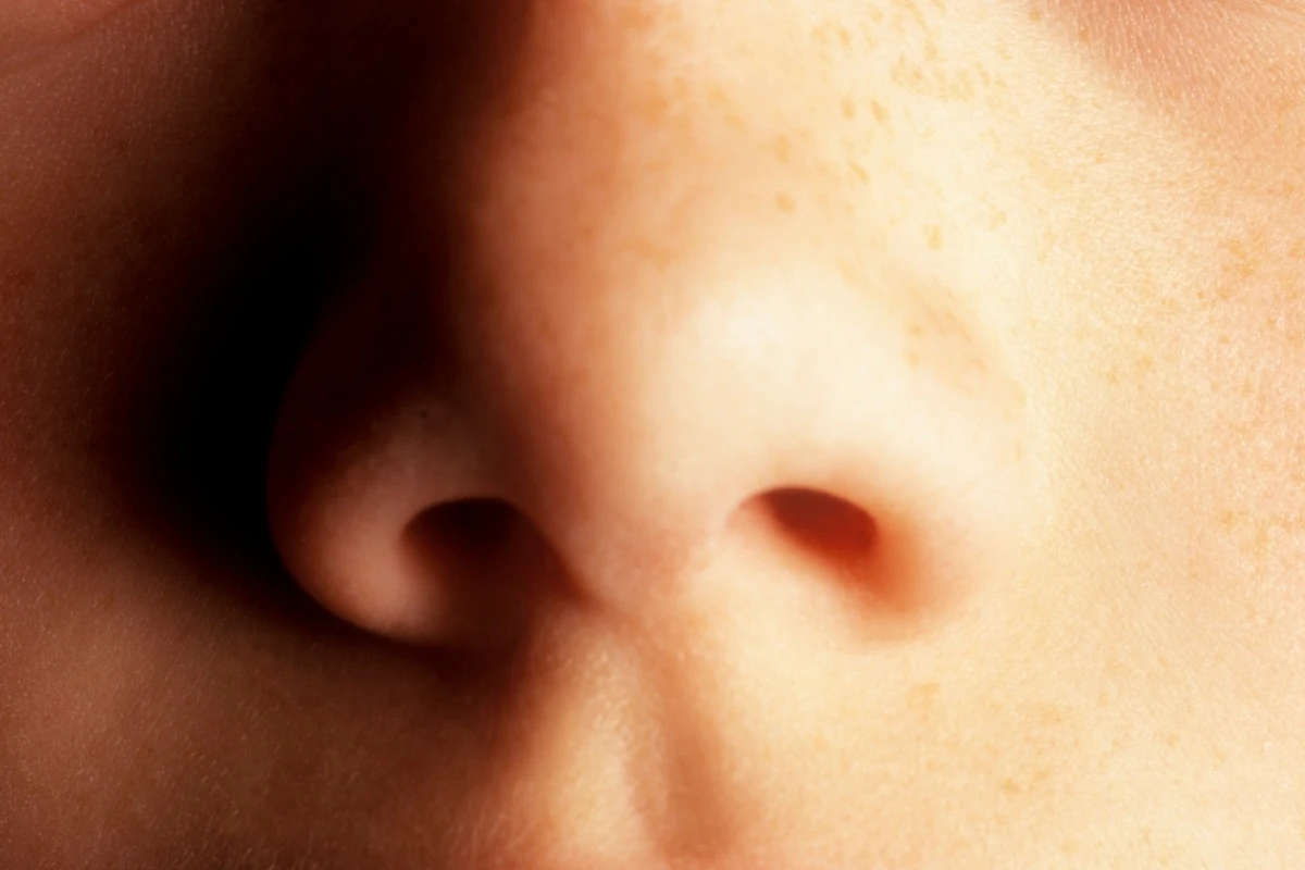 A woman who noticed her husband developed a distinctive smell has led to skin-secreted volatile biomarkers indicating Parkinson's disease being identified