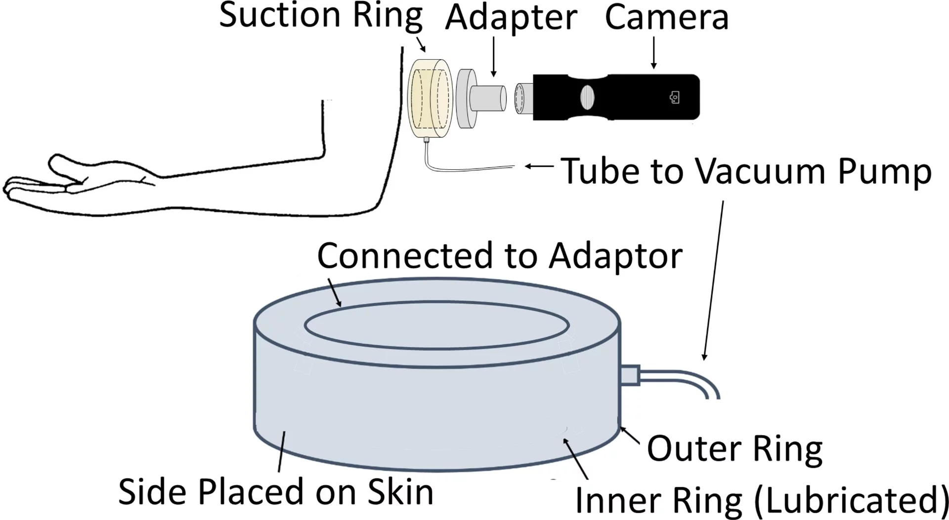 A schematic of Binghamton University's scar-minimizing device