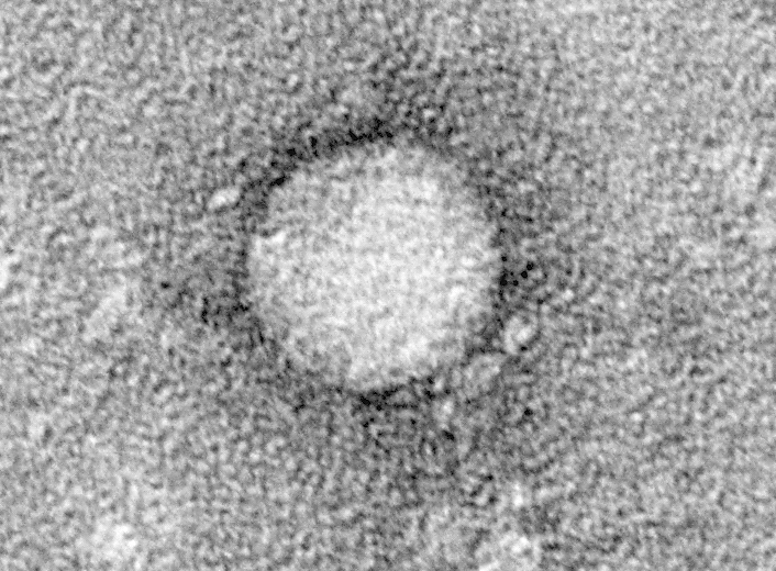 The hepatitis C virus affects between 130 and 170 million people worldwide and current treatment options have strong side effects