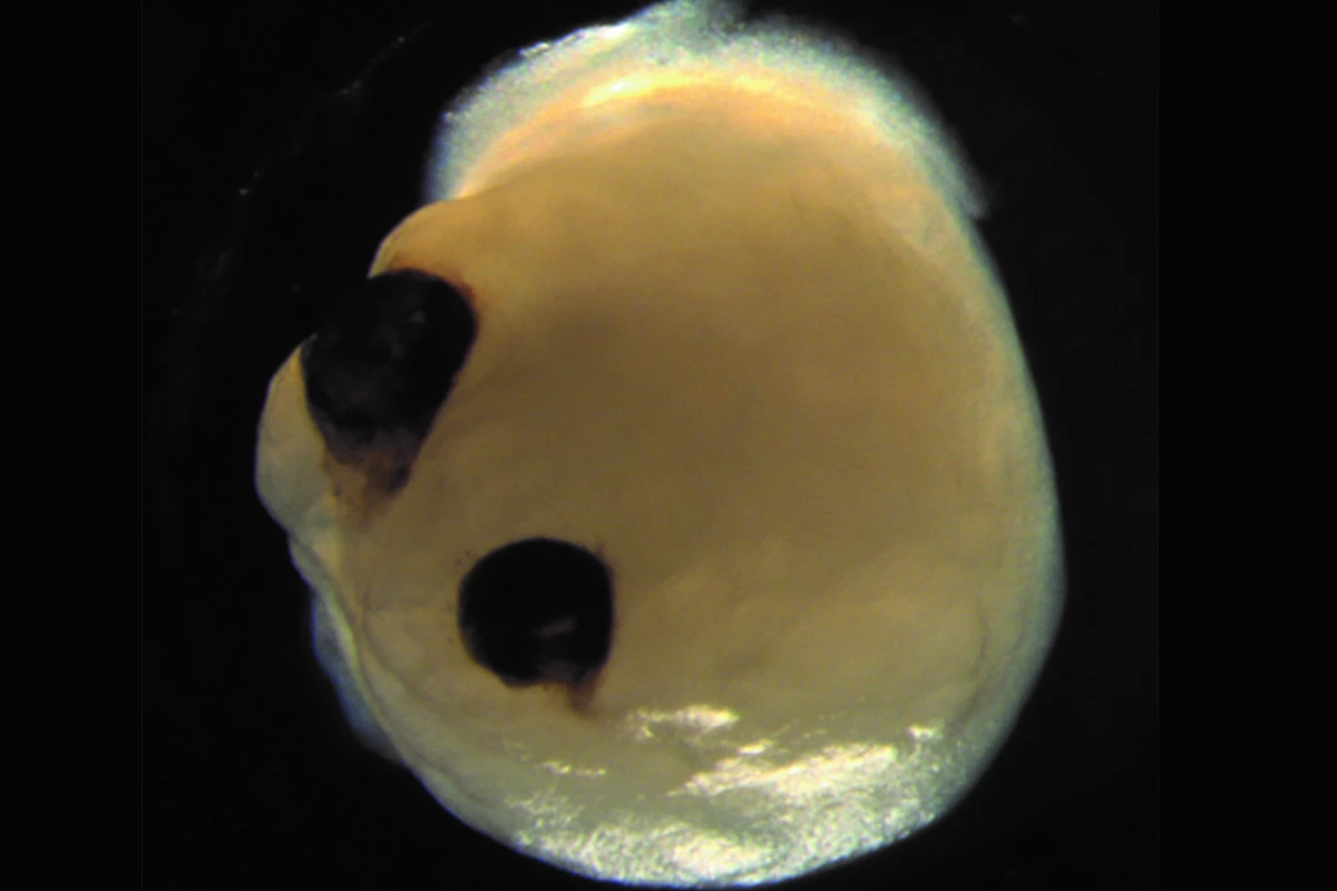 A brain organoid, with two optic cups that can detect light