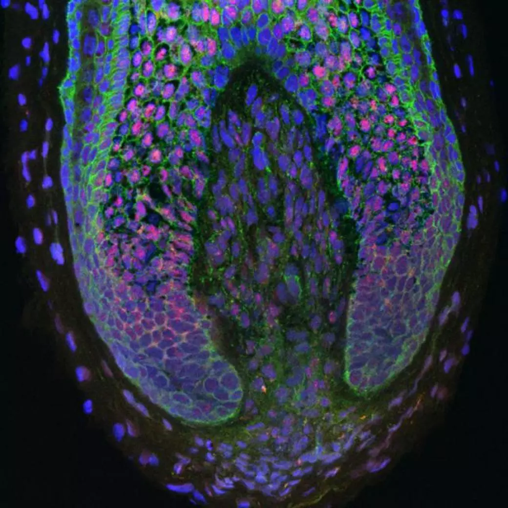A cross-section of a human hair follicle