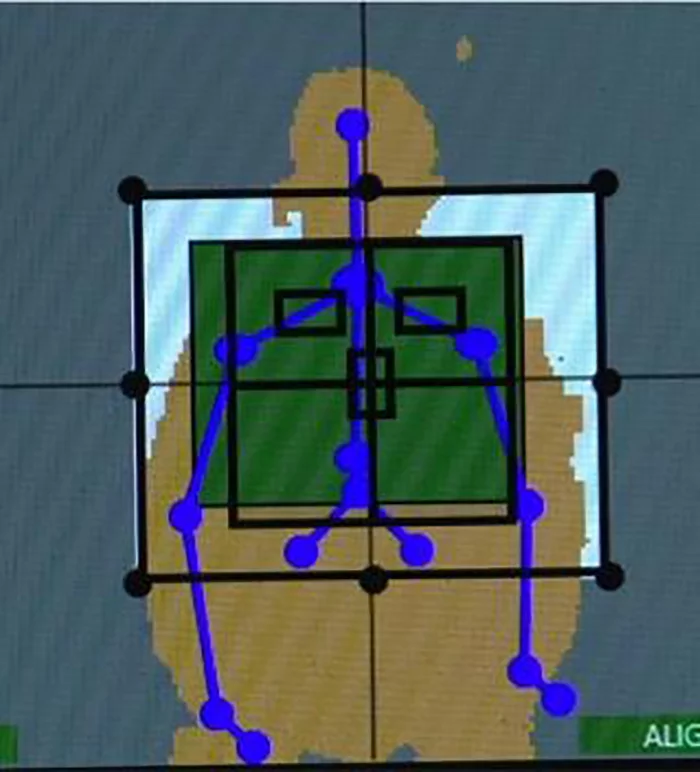 Technology adapted from the Xbox gaming system may help technicians produce high-quality X-rays with minimal radiation exposure