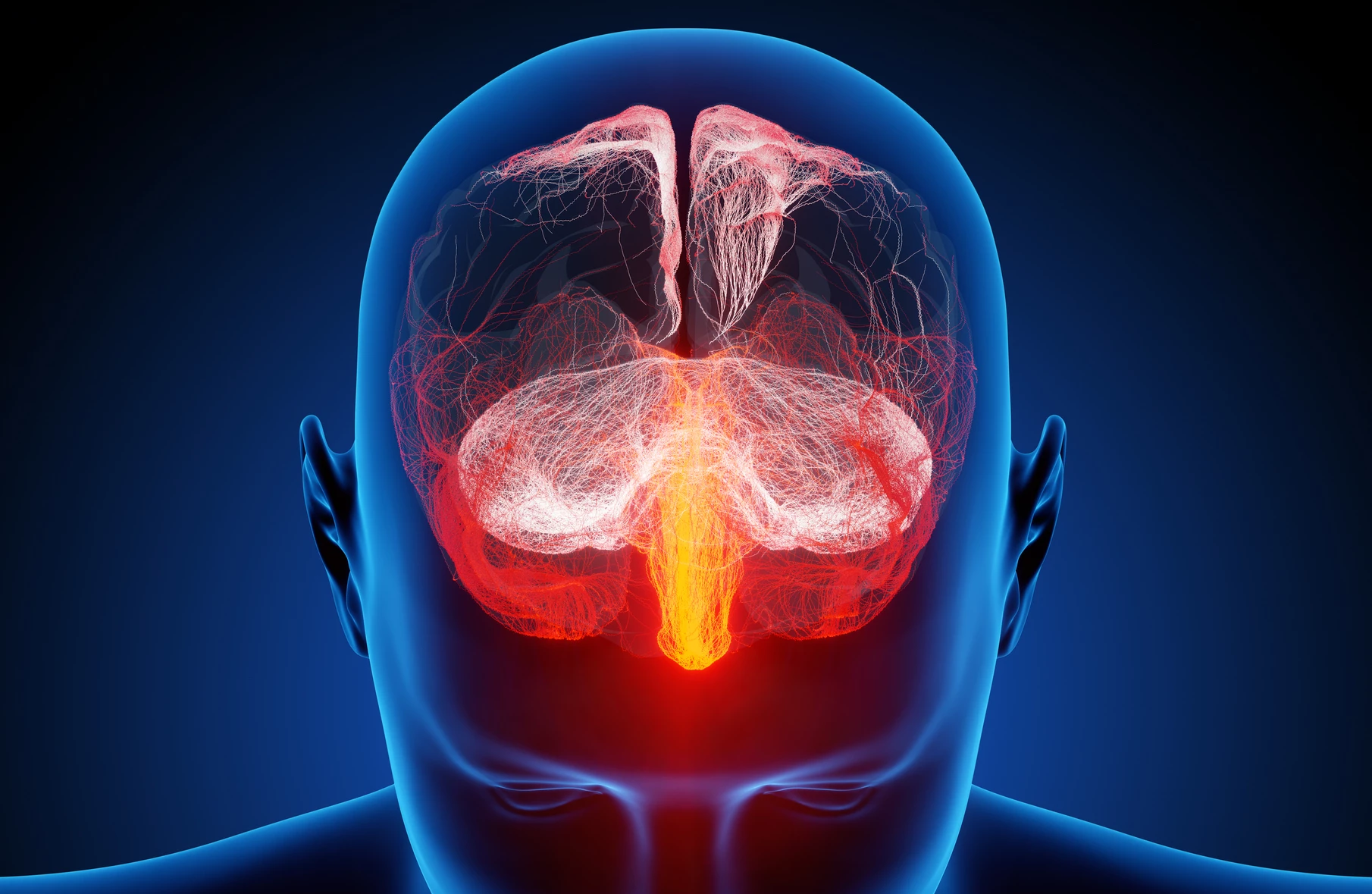 A new study has found a link between the build-up of damaging toxic proteins and the presence of neuroinflammation in three different types of dementia