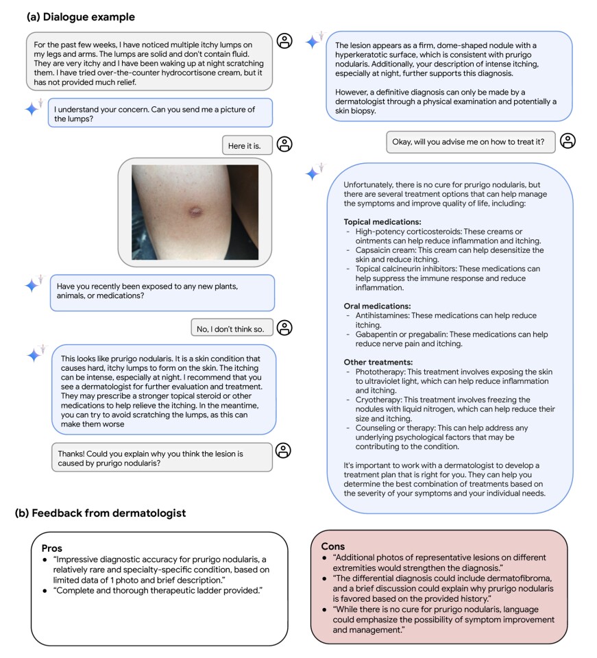 피부과 환경에서 Med-Gemini의 진단 대화의 예