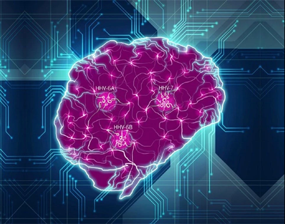 A new study has resurrected an old hypothesis suggesting the herpes simplex virus may play a major role in the onset of Alzheimer's disease