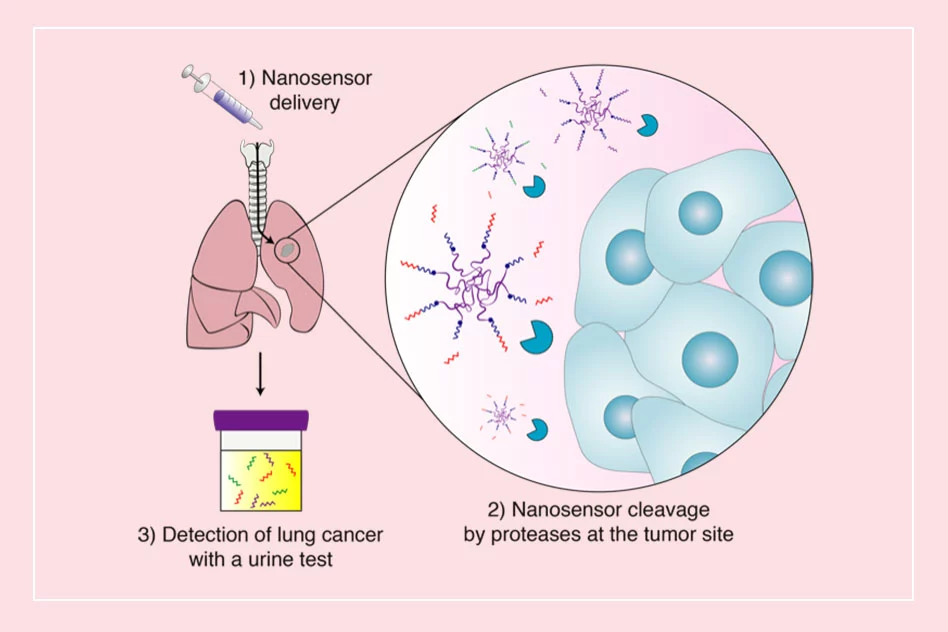 MIT's nanoparticles interact with enzymes used by cancer cells to produce biomarkers that can be detected in urine
