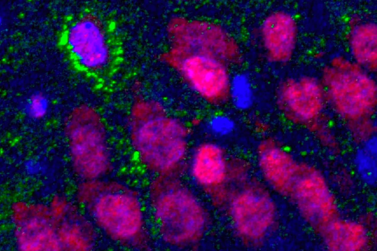A newborn neuron (upper left) in the brain of an older adult