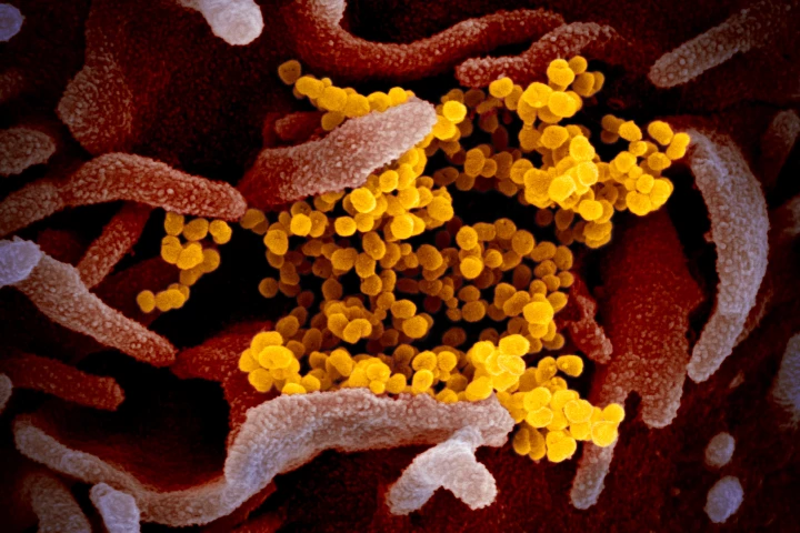 This scanning electron microscope image shows SARS-CoV-2 colored yellow, emerging from the surface of cells (colored pink)