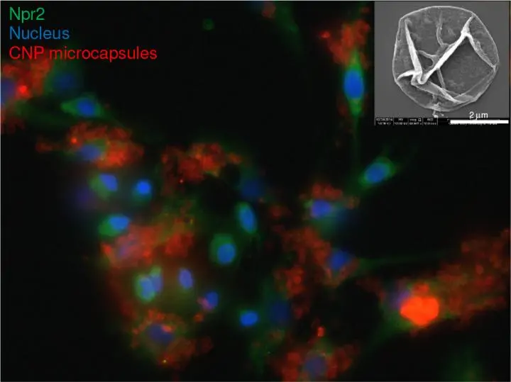 Microcapsules could be used to deliver the protein molecule CNP to the site of inflammation and tissue damage of osteoarthritis sufferers (Photo: QMUL)