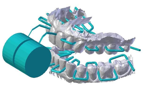Diagram showing the dental floss moving between the teeth with just one bite