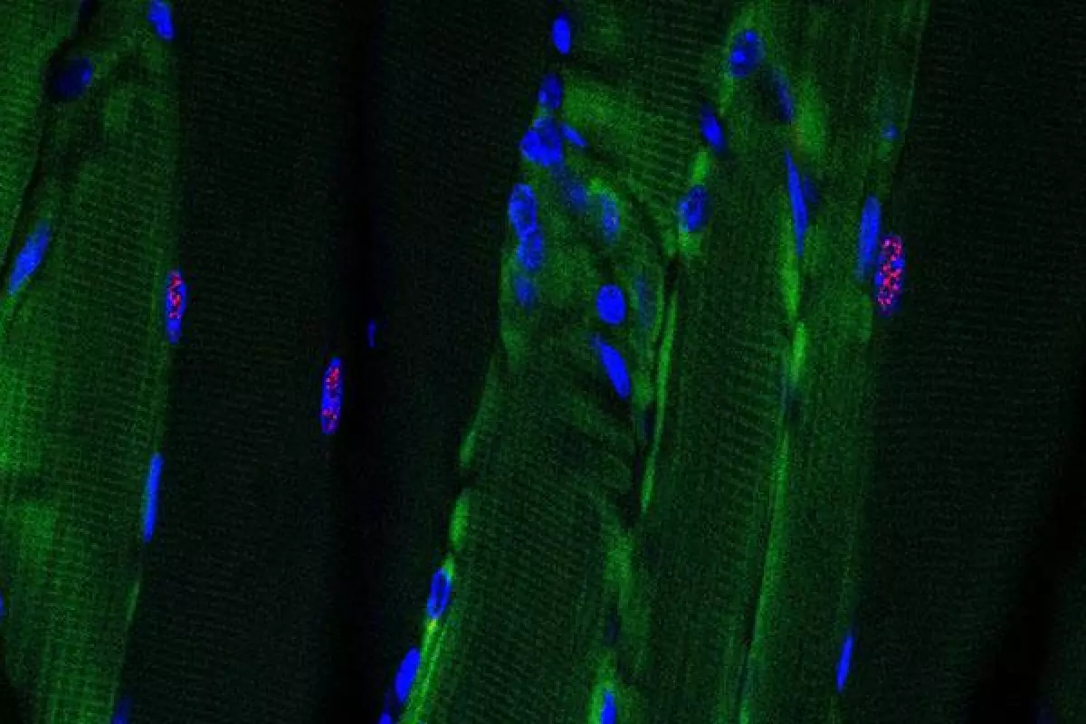 Muscle fibers treated with a new RNA-targeted Cas9 technique show a lack of toxic RNA buildup (seen in red)