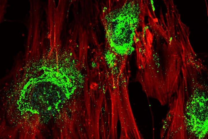 A microscope image of stem cells turning into bone cells – green indicates collagen, which the cells produce as a by-product of the process