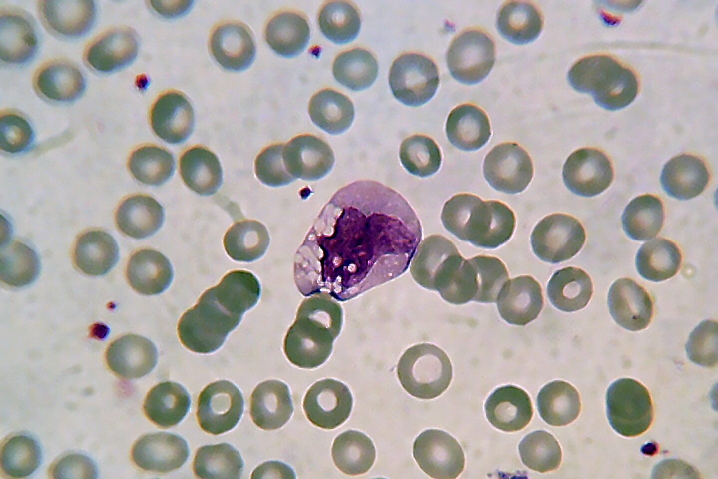 The large, purple-stained cell in the center of the image is a monocyte, a type of white blood cell