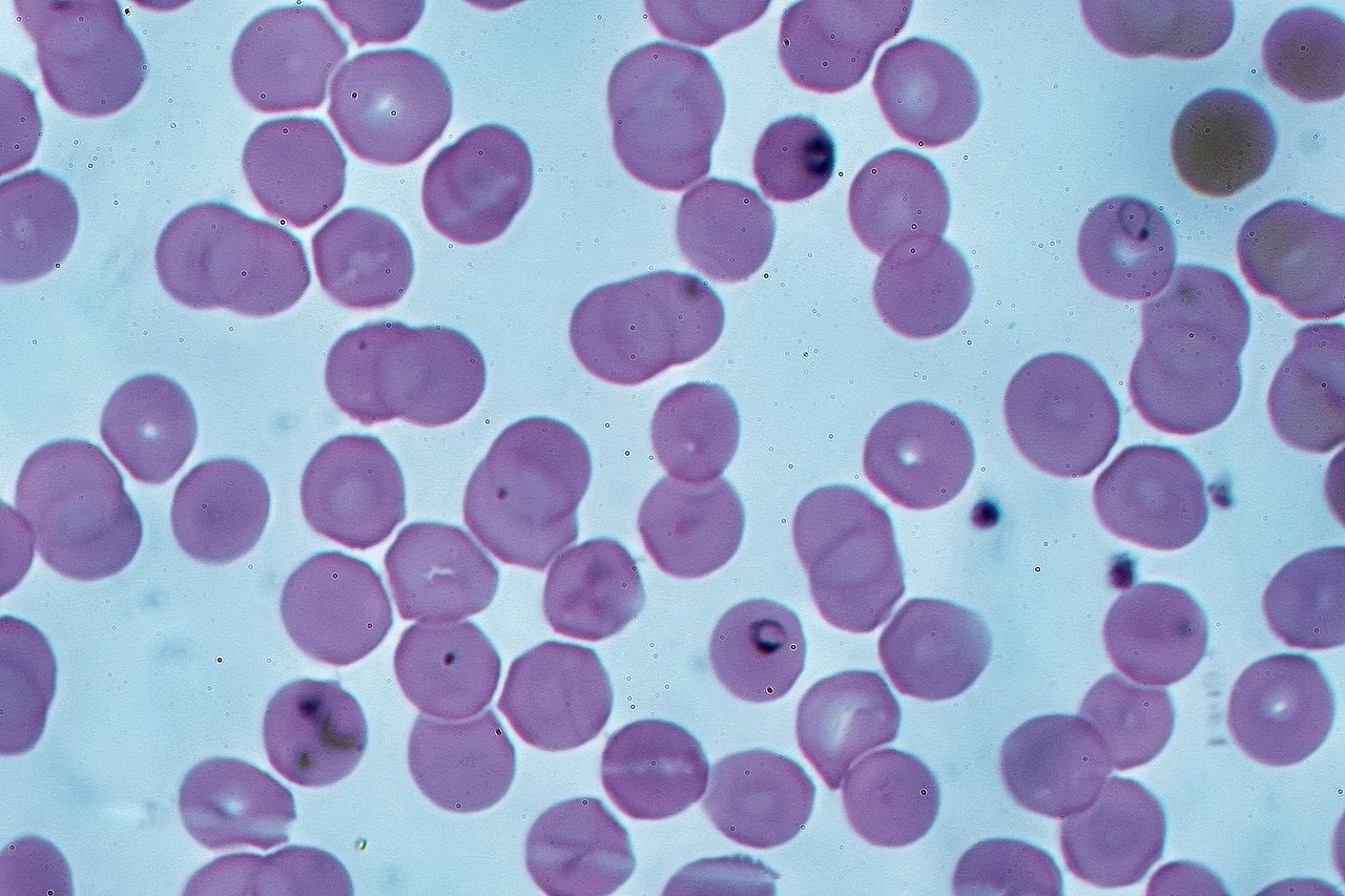 Ring forms of P. falciparum in red blood cells