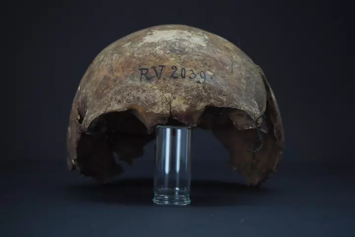 The skull of RV 2039, a hunter-gatherer buried in Latvia around 5,000 years ago