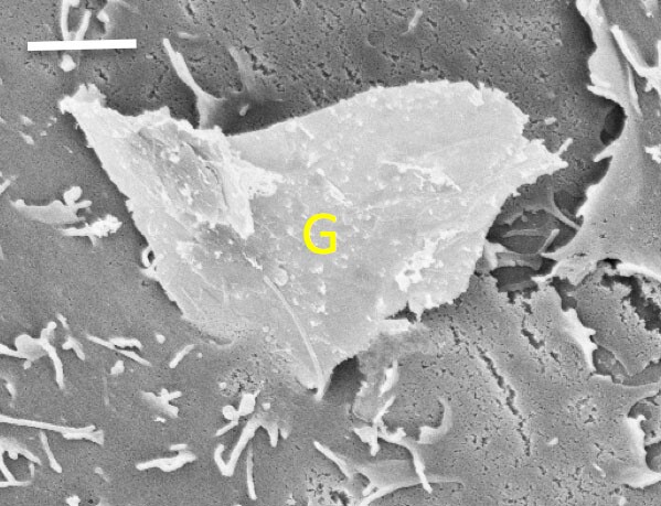 The bottom corner of a piece of graphene penetrates a cell membrane - mechanical properties like rough edges and sharp corners can make graphene dangerous to human cells. Scale bar represents two microns. (Image: Kane lab/Brown University)