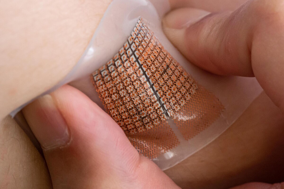 Wearable ultrasound patch could warn of cardiovascular problems