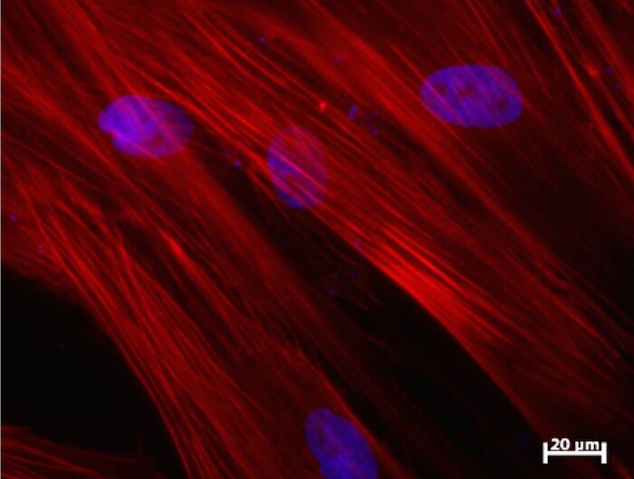 Stem cells which are functioning again, after being "rebooted" by the Nanog gene