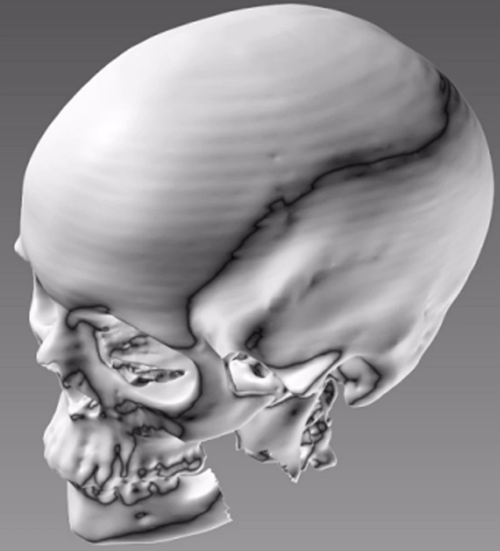 Further adding to ITOP's potential is its ability to take data from the CT or MRI scans and make bespoke tissue for patients