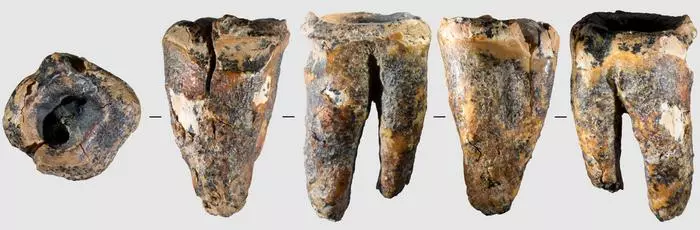 Chagyrskaya 64 molar tooth and its macro-features: General view of the tooth in five projections