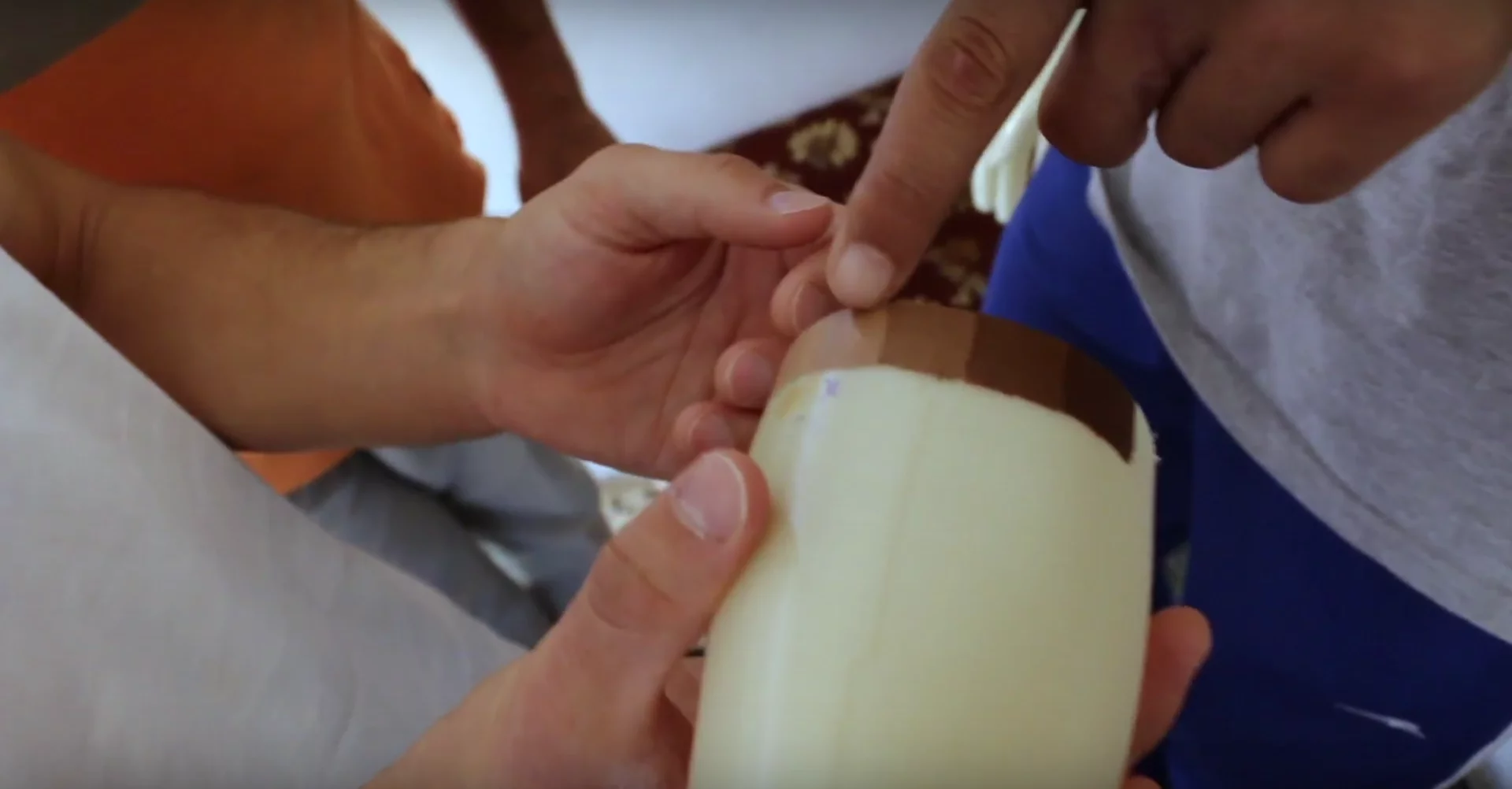 The prostheses can be painted to match the patient's skin tone