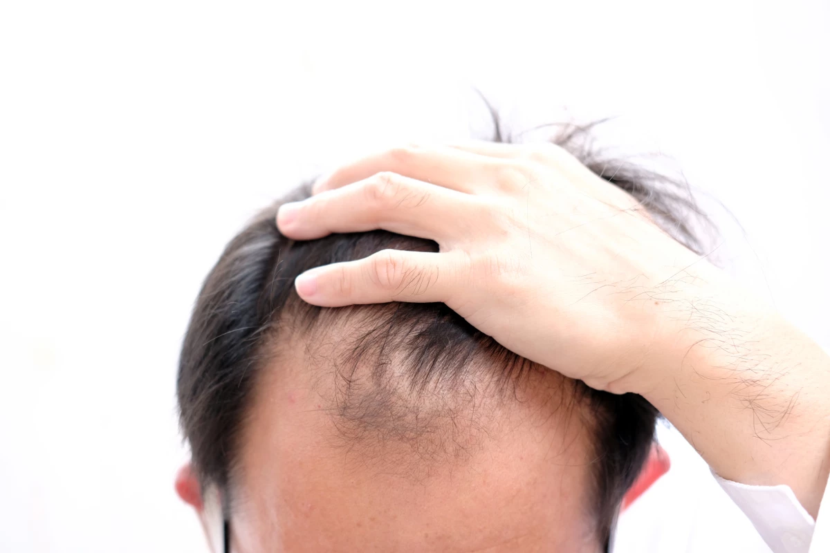 A gel of microsized keratin spheres promoted hair growth in mice