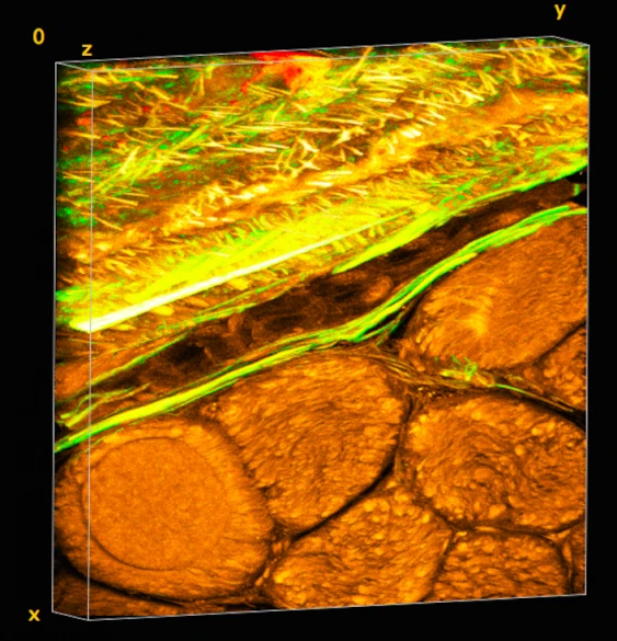 Periosteum is a tissue fabric layer on the outside of bone, as seen in the upper diagonal segment of the tissue image volume – the natural weave of elastin (green) and collagen (yellow) are evident when viewed under the microscope