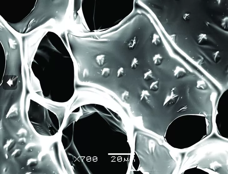 A scanning electron microscope image of the nanowire-alginate composite scaffolds, showing the star-shaped clusters of nanowires (Image: Disease Biophysics Group, Harvard University)