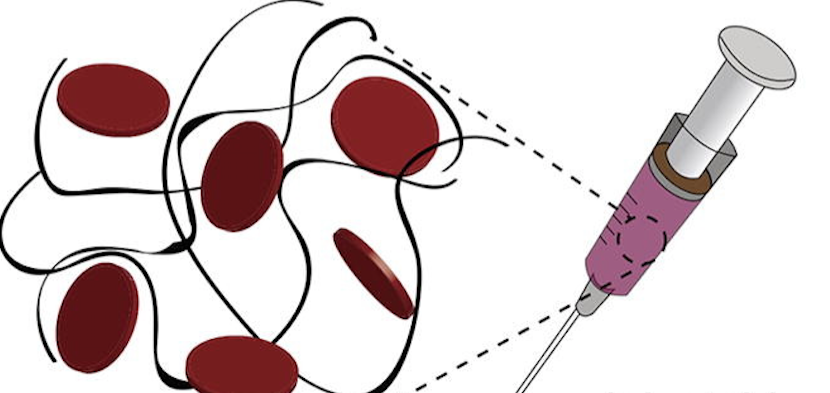 An injectable hydrogel containing nanoparticles promises to rapidly stop bleeding and enhance wound healing